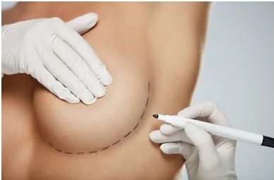 breast augmentation London Plastic Surgery