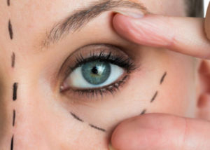 eyelid surgery mistakes