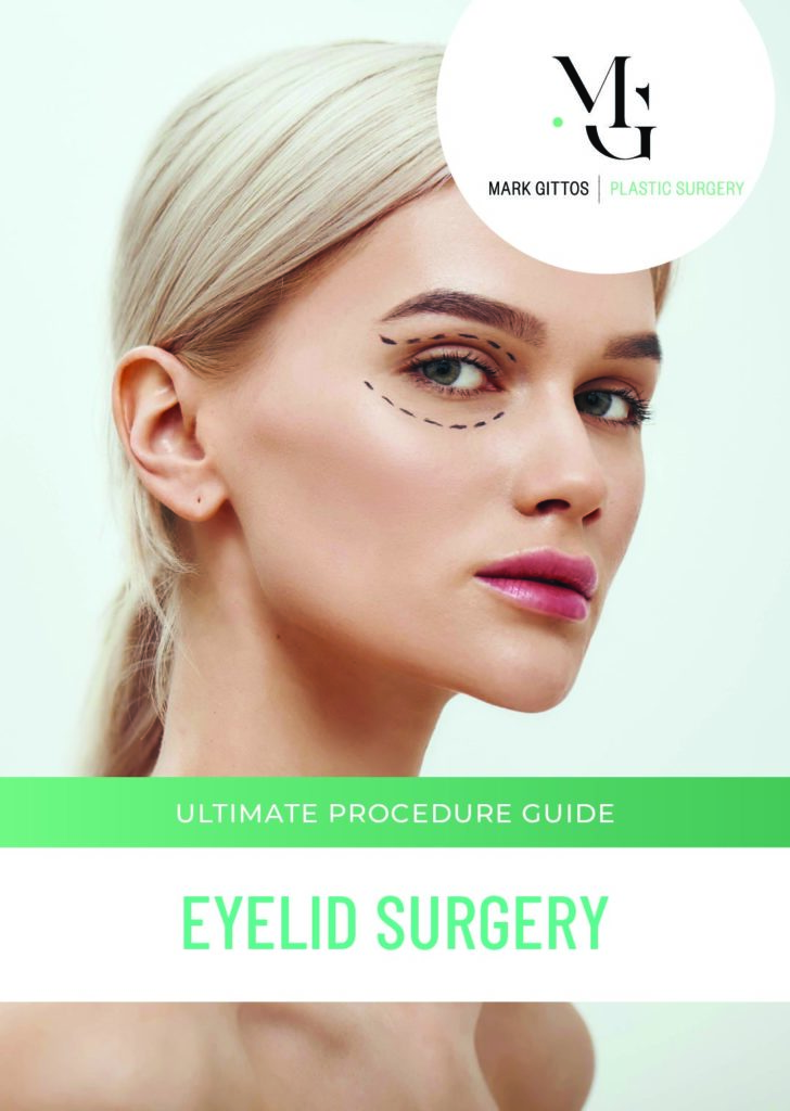 Guide Blepharoplasty