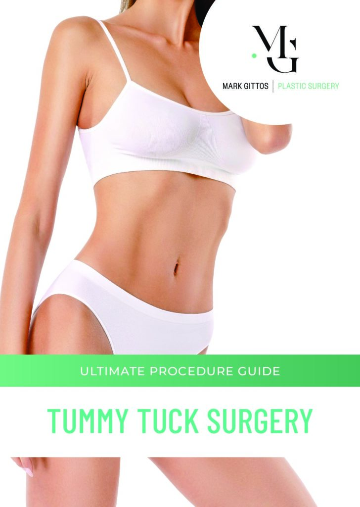 Guide Tummy Tuck