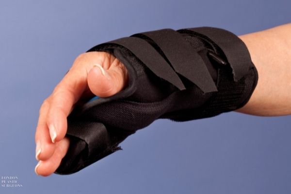 Hand Ligament Injury Treatment Mr Mark Gittos Best Plastic Surgeon UK