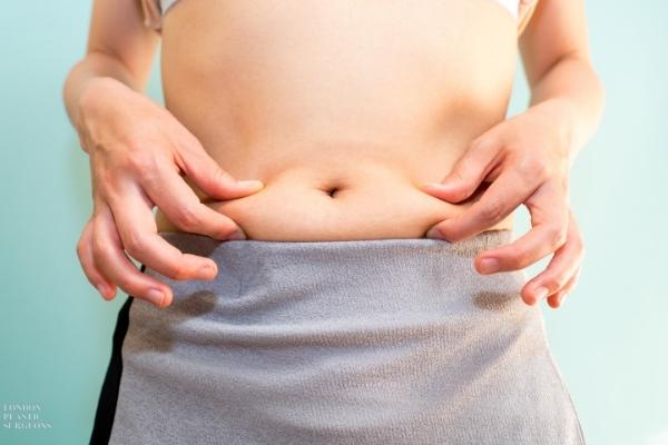 Tummy Tuck FAQs Mr Mark Gittos Plastic Surgeon Specialist UK