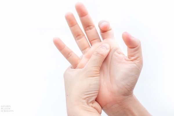 Symptoms Trigger Finger Mr Mark Gittos Best Plastic Surgeon UK